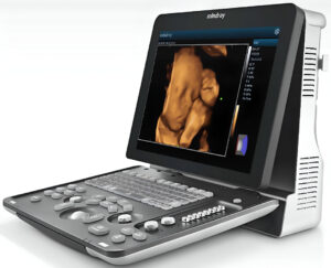 Ultrasonido portátil  Z60